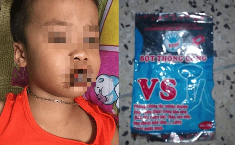 Những Sai Lầm Thường Gặp Khi Diệt Chuột