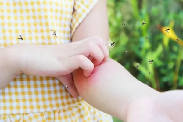 Vì sao nên phòng và diệt trừ muỗi? Vì sao nên phòng và diệt trừ muỗi?