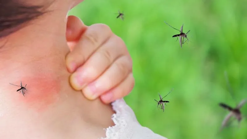 Vì Sao Muỗi Đốt Lại Ngứa? Giải Mã Hiện Tượng Gây Khó Chịu Này Vì Sao Muỗi Đốt Lại Ngứa? Giải Mã Hiện Tượng Gây Khó Chịu Này